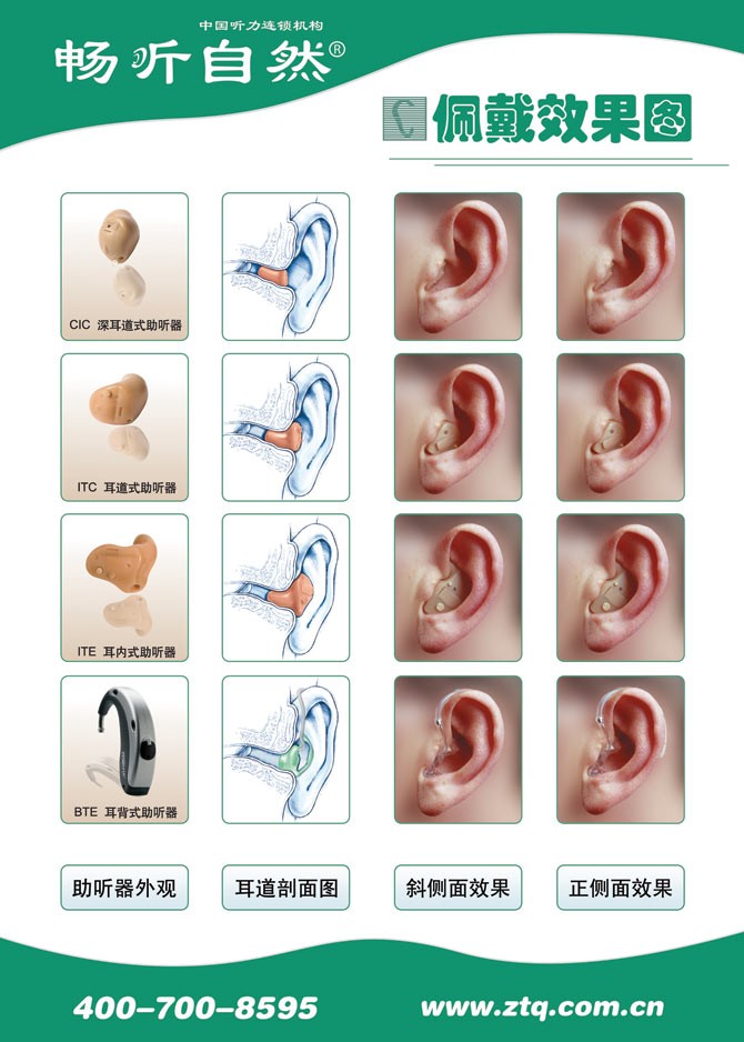 助聽器佩戴效果
