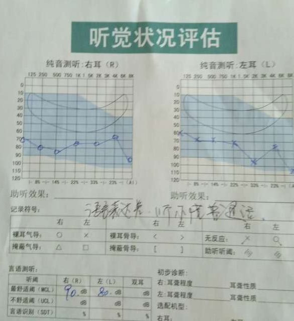 兒童聽力檢測報告